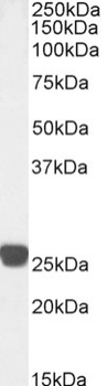 Mouse Monoclonal Antibody to Cardiac Troponin I