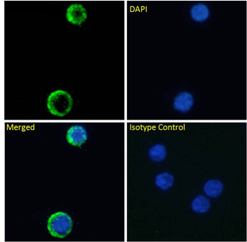 Anti-Interleukin 7 Receptor [YIL7R323]