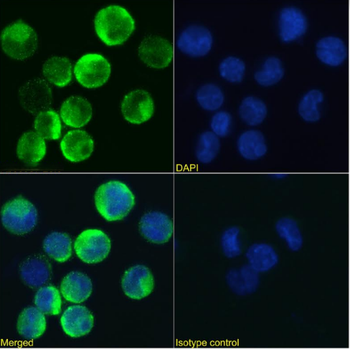 Anti-CD131 [BION-1]