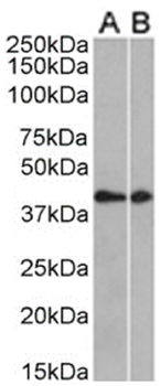 Anti-CCRL2 [BZ5B8]