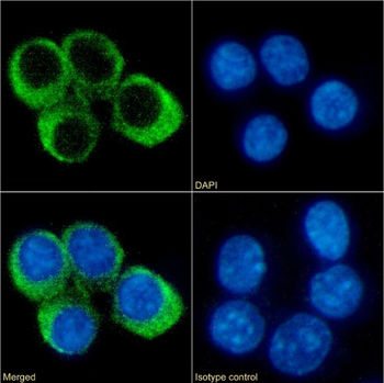 Anti-CCRL2 [BZ2E3]