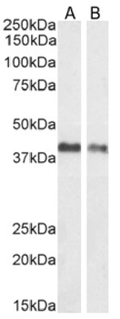 Anti-EpCAM [HEA125]