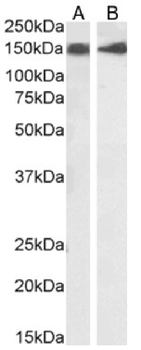 Anti-CD56 [NCAM12.19]