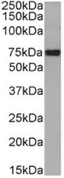 Anti-CD36 [185-1G2 (B467)]