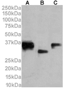 Anti-CD74 [LN-2]