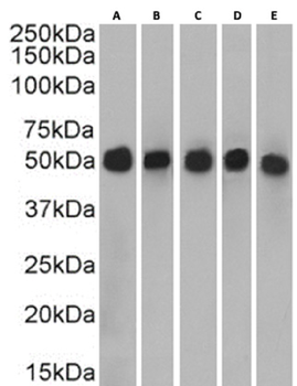 Anti-Cytokeratin 7 [OV-TL 12/30]