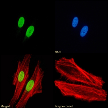 Anti-H4 K8Ac; K12Ac; K16Ac [KM-2]