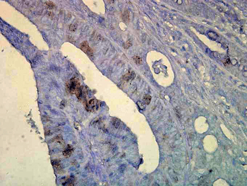 HSP70 Antibody (Biotin)