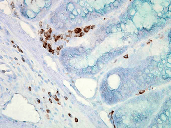 HSP70 Antibody (HRP)