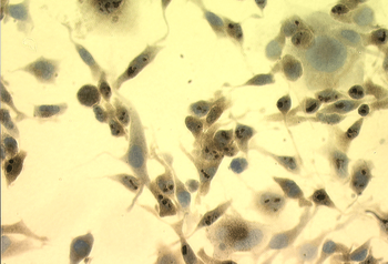 HSP70 Antibody (PerCP)