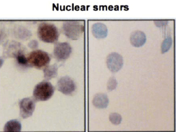 HSP70/HSC70 Antibody (FITC)