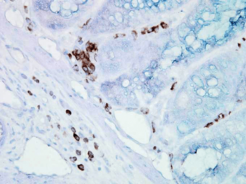 HSP70/HSC70 Antibody (HRP)