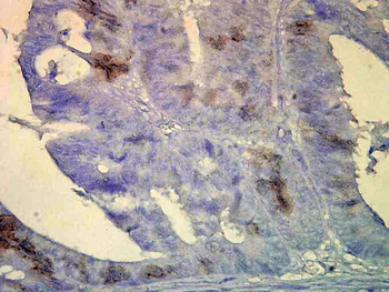 HSP70/HSC70 Antibody (PerCP)