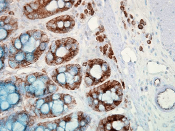 HSP90 Antibody (FITC)