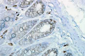 HSP90 Antibody (FITC)
