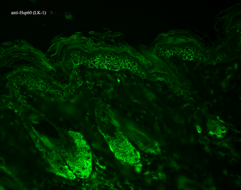 HSP60 Antibody (FITC)