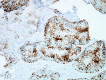 HSP60 Antibody (PerCP)