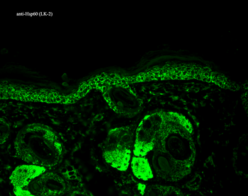 HSP60 Antibody (HRP)