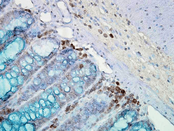 HSP90 Antibody (APC)