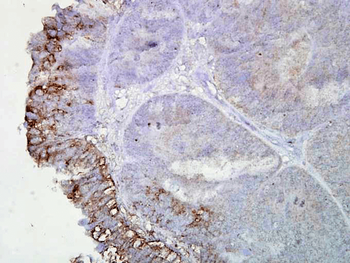 HSP90 Antibody (HRP)