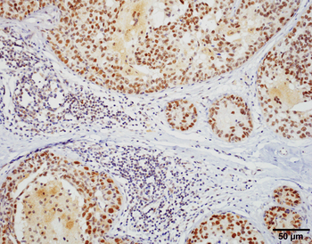 HSF1 Antibody (FITC)