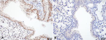 HSF1 Antibody (FITC)