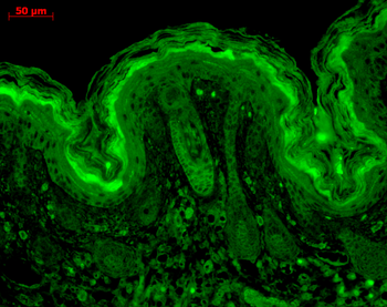 CaMKII Antibody (Biotin)