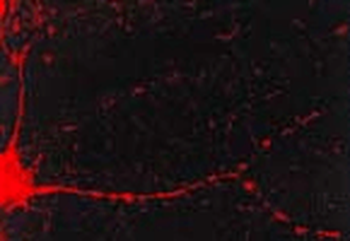 CaMKII Antibody (Biotin)