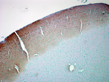 CaMKII Antibody (FITC)