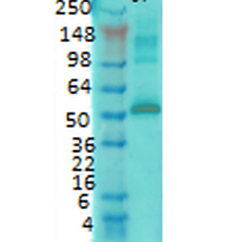 CaMKII Antibody (HRP)