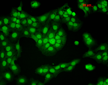 CaMKII Antibody (RPE)