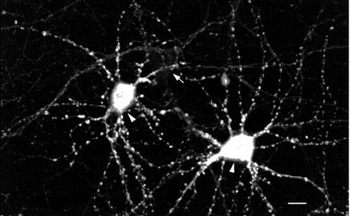 CaMKII Antibody (APC)