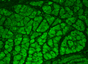 CaMKII Antibody (Biotin)