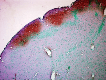 CaMKII Antibody (HRP)