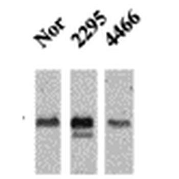 CaMKII Antibody (HRP)