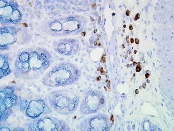 HSP90 Antibody (FITC)