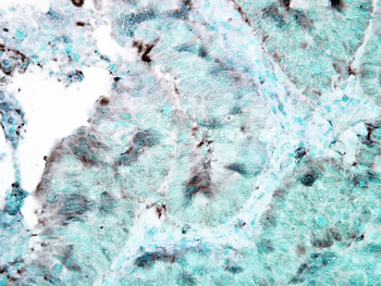 HSP90 Antibody (PerCP)
