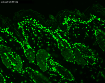 Acetylated Lysine Antibody (RPE)