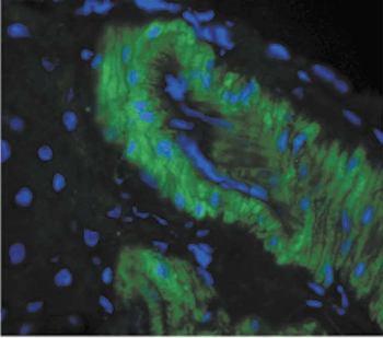 Nitrotyrosine Antibody (APC)