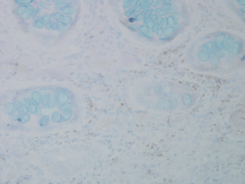 Nitrotyrosine Antibody (APC)