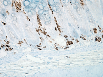 Nitrotyrosine Antibody (HRP)
