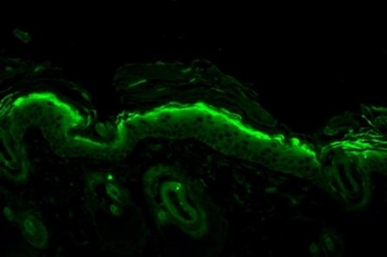 Nitrotyrosine Antibody (PerCP)