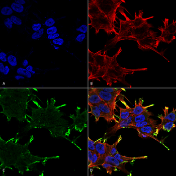 Alpha B Crystallin Antibody (FITC)
