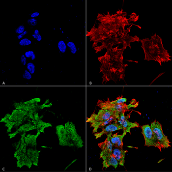 Alpha B Crystallin Antibody (RPE)
