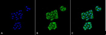 GRP78 Antibody (RPE)