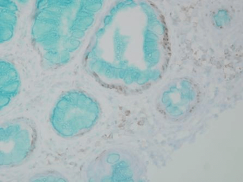 DNMT1 Antibody (APC)