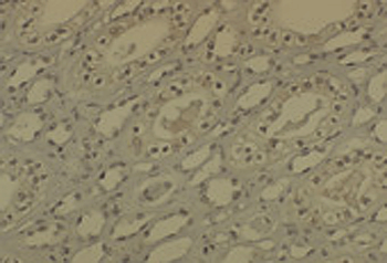DNMT1 Antibody (APC)