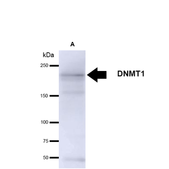 DNMT1 Antibody (RPE)