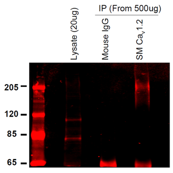 Cav1.2 Antibody (Biotin)