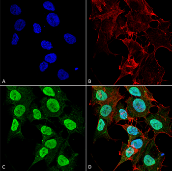 Cav1.2 Antibody (HRP)